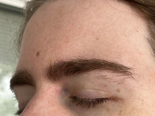 Why Electrolysis Is the Smarter Answer to Stray Brow Hairs That Keep Coming Back